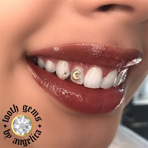 Tooth Jewelry, Tooth Gems, Dental Jewelry 